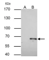 Anti-TRAF6 antibody [N2C2], Internal used in Immunoprecipitation (IP). GTX113029