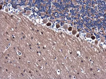 Anti-TRAF6 antibody [N2C2], Internal used in IHC (Paraffin sections) (IHC-P). GTX113029