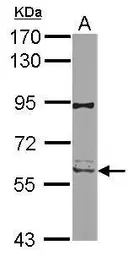 Anti-RIP2 antibody used in Western Blot (WB). GTX113044