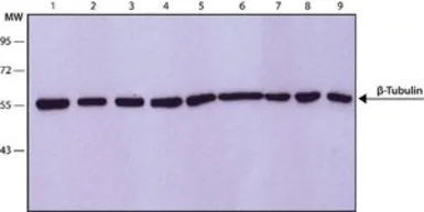 Anti-beta Tubulin antibody [D66] used in Western Blot (WB). GTX11307