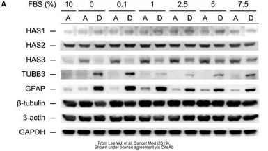 Anti-beta Tubulin antibody [D66] used in Western Blot (WB). GTX11307