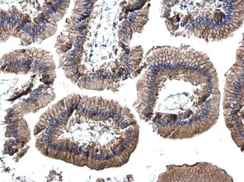Anti-EpCAM antibody [N3C3] used in IHC (Paraffin sections) (IHC-P). GTX113091