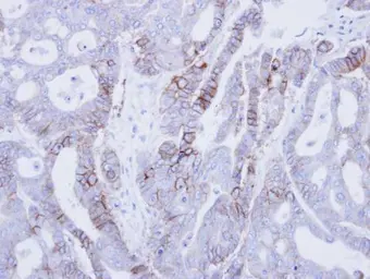 Anti-EpCAM antibody [N3C3] used in IHC (Paraffin sections) (IHC-P). GTX113091
