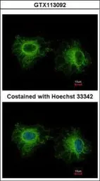 Anti-Fast skeletal myosin light chain 1 antibody used in Immunocytochemistry/ Immunofluorescence (ICC/IF). GTX113092