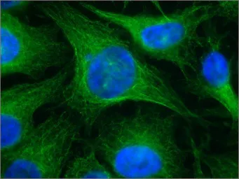 Anti-beta Tubulin I antibody [SAP.4G5] used in Immunocytochemistry/ Immunofluorescence (ICC/IF). GTX11312