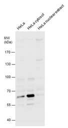 Anti-cIAP2 antibody [C1C3] used in Western Blot (WB). GTX113128