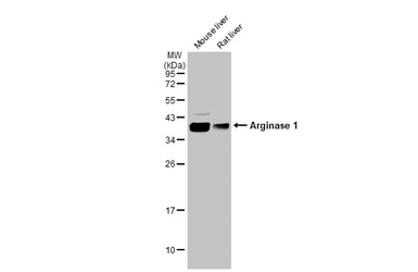 Anti-Arginase 1 antibody used in Western Blot (WB). GTX113131