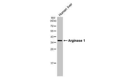 Anti-Arginase 1 antibody used in Western Blot (WB). GTX113131