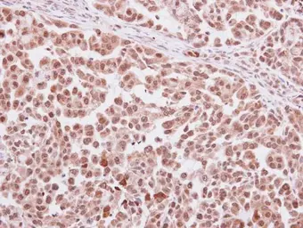Anti-Antithrombin III antibody used in IHC (Paraffin sections) (IHC-P). GTX113132