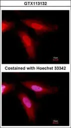 Anti-Antithrombin III antibody used in Immunocytochemistry/ Immunofluorescence (ICC/IF). GTX113132