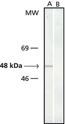 Anti-gamma Tubulin antibody [GTU-88] used in Western Blot (WB). GTX11316