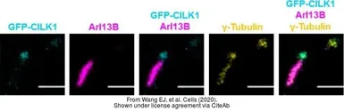 Anti-gamma Tubulin antibody [GTU-88] used in Immunocytochemistry/ Immunofluorescence (ICC/IF). GTX11316