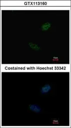 Anti-CDX2 antibody used in Immunocytochemistry/ Immunofluorescence (ICC/IF). GTX113160