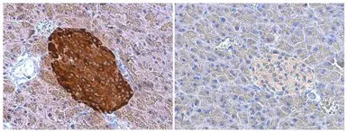 Anti-Chromogranin A antibody used in IHC (Paraffin sections) (IHC-P). GTX113165