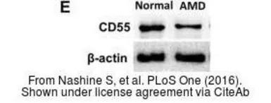 Anti-CD55 antibody [N1C2] used in Western Blot (WB). GTX113170