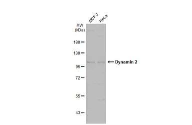 Anti-Dynamin 2 antibody [N1N3] used in Western Blot (WB). GTX113171