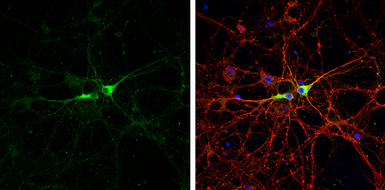 Anti-GAD67 antibody used in Immunocytochemistry/ Immunofluorescence (ICC/IF). GTX113190
