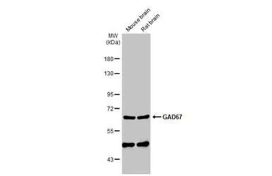 Anti-GAD67 antibody used in Western Blot (WB). GTX113190