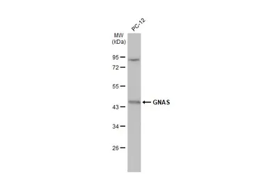 Anti-GNAS antibody [C2C3-2], C-term used in Western Blot (WB). GTX113200