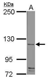 Anti-CD42b antibody used in Western Blot (WB). GTX113202