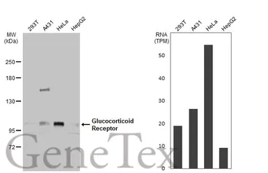 Anti-Glucocorticoid Receptor antibody used in Western Blot (WB). GTX113208