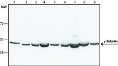 Anti-gamma Tubulin antibody used in Western Blot (WB). GTX11321