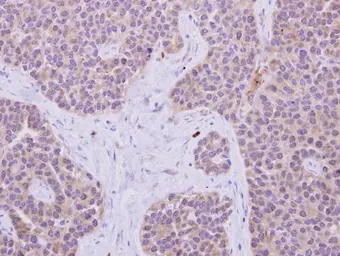 Anti-IRS1 antibody [C2C3], C-term used in IHC (Paraffin sections) (IHC-P). GTX113213