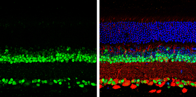 Anti-PAX6 antibody used in IHC (Paraffin sections) (IHC-P). GTX113241