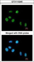 Anti-PIN1 antibody [N1C3-2] used in Immunocytochemistry/ Immunofluorescence (ICC/IF). GTX113245