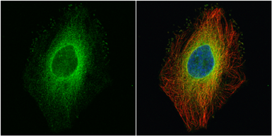Anti-ROCK1 antibody [N1N2], N-term used in Immunocytochemistry/ Immunofluorescence (ICC/IF). GTX113266