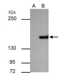 Anti-ROCK1 antibody [N1N2], N-term used in Immunoprecipitation (IP). GTX113266