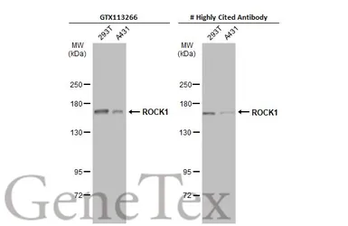 Anti-ROCK1 antibody [N1N2], N-term used in Western Blot (WB). GTX113266