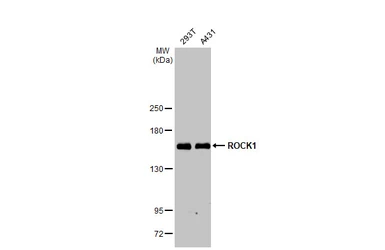 Anti-ROCK1 antibody [N1N2], N-term used in Western Blot (WB). GTX113266