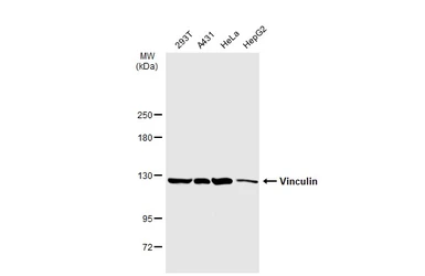 Anti-Vinculin antibody [N1N3] used in Western Blot (WB). GTX113294