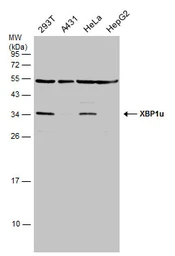 Anti-XBP1 antibody [N1C3] used in Western Blot (WB). GTX113295