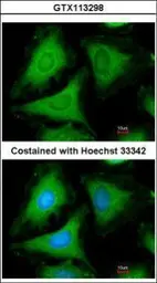 Anti-14-3-3 gamma antibody used in Immunocytochemistry/ Immunofluorescence (ICC/IF). GTX113298