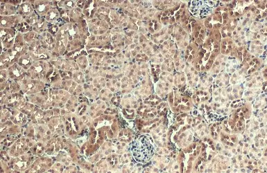 Anti-AKT3 antibody used in IHC (Paraffin sections) (IHC-P). GTX113312