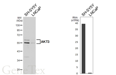 Anti-AKT3 antibody used in Western Blot (WB). GTX113312