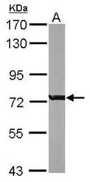 Anti-RACGAP1 antibody [N1N2], N-term used in Western Blot (WB). GTX113320