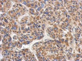 Anti-RACGAP1 antibody [C1C3] used in IHC (Paraffin sections) (IHC-P). GTX113322