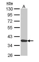 Anti-Annexin A1 antibody used in Western Blot (WB). GTX113329