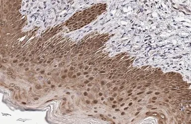 Anti-PPAR gamma antibody used in IHC (Paraffin sections) (IHC-P). GTX113344