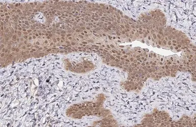 Anti-PPAR gamma antibody used in IHC (Paraffin sections) (IHC-P). GTX113344