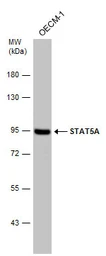 Anti-STAT5A antibody [C2C3], C-term used in Western Blot (WB). GTX113351