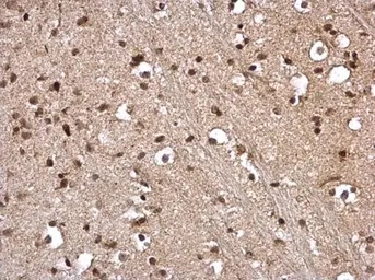 Anti-STAT5A antibody [C2C3], C-term used in IHC (Paraffin sections) (IHC-P). GTX113351