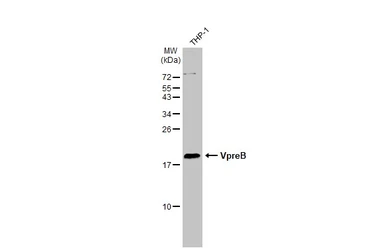 Anti-VpreB antibody [N3C3] used in Western Blot (WB). GTX113368