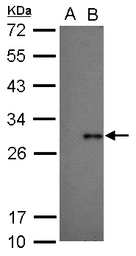 Anti-Dengue virus Type 2 NS4B protein antibody used in Western Blot (WB). GTX113374