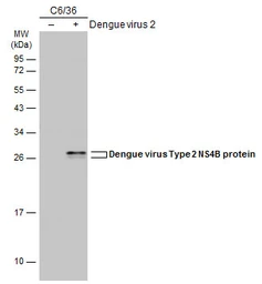Anti-Dengue virus Type 2 NS4B protein antibody used in Western Blot (WB). GTX113375