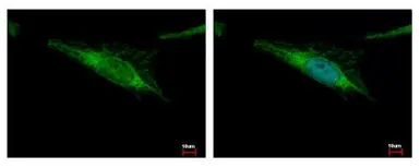 Anti-ALDH2 antibody [N1C1] used in Immunocytochemistry/ Immunofluorescence (ICC/IF). GTX113379