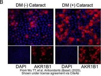 Anti-AKR1B1 antibody [N1C3] used in Immunohistochemistry (IHC). GTX113381